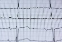 fusion beam of stellar